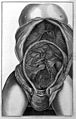 Jenty; anatomy of the womb and foetus Wellcome L0030023.jpg