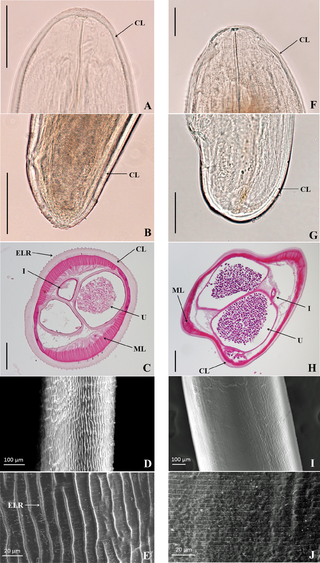 <span class="mw-page-title-main">Dirofilariasis</span> Human disease transmitted by mosquitoes