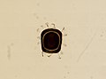 Pectinatella magnifica (YPM IZ 100975).jpeg