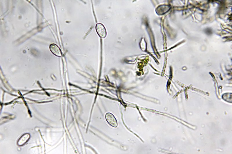 File:Spores7.jpg