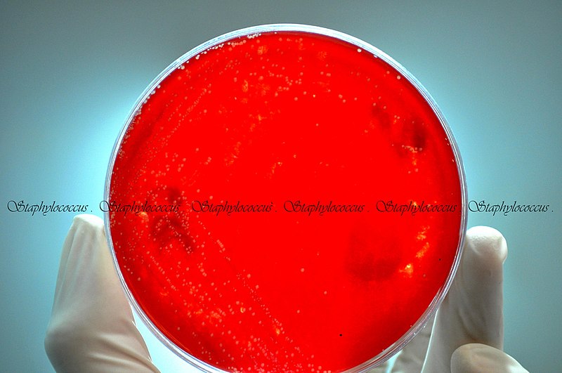 File:Staphylococcus aureus on agar.jpg