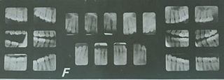 <span class="mw-page-title-main">Forensic dentistry</span> Aspect of criminal investigation