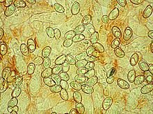 Basidiospores of Volvopluteus gloiocephalus Volvopluteus gloiocephalus - Basidiospores.jpg