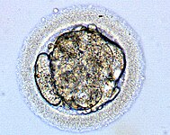 Эмбрион человека на 4-е сутки развития.jpg