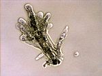 Amoeba proteus (Lobosa: Tubulinea)