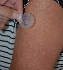 A transdermal patch which delivers medication is applied to the skin. The patch is labelled with the time and date of administration as well as the administrator's initials. Applying transdermal patch.jpg