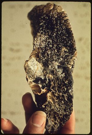 BIRMINGHAM COAL MINER'S LUNG SHOWING EFFECT OF BLACK LUNG DISEASE. (FROM THE SITES EXHIBITION. FOR OTHER IMAGES IN... - NARA - 553848.jpg
