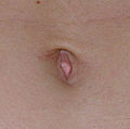 Belly-button.jpg