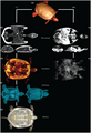 CT and MRI of a red-eared slider (Trachemys scripta). Source: Lauridsen, Henrik; Hansen, Kasper; Wang, Tobias; Agger, Peter; Andersen, Jonas L.; Knudsen, Peter S.; Rasmussen, Anne S.; Uhrenholt, Lars; Pedersen, Michael (2011). "Inside Out: Modern Imaging Techniques to Reveal Animal Anatomy". PLoS ONE. 6 (3): e17879. doi:10.1371/journal.pone.0017879. PMID 21445356.((cite journal)): CS1 maint: unflagged free DOI (link).