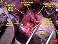 Corazón fetal - arteria coronaria dereita.