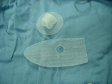 Polypropylene (PP) mesh is currently used in both hernia and pelvic organ prolapses, but may not always be the most biocompatible option. Hernia mesh 1.jpg