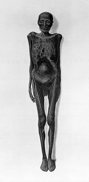 File:Illustration of Graeco-Egyptian mummy Wellcome L0016109.jpg