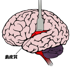 Insula cortex ja.png