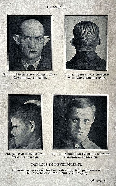 File:Man's head seen from the front and back, showing large ears Wellcome V0030036.jpg