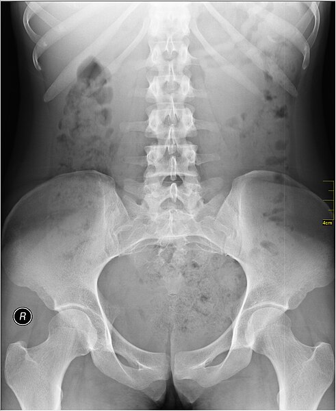 File:Medical X-Ray imaging SAS07 nevit.jpg