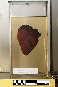 Nyala heart Nyala heart (Tragelaphus angasii).jpg