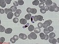 Plasmodium falciparum - gametocytes.