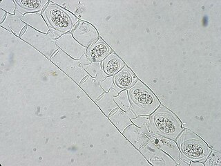 Spirogyra („Schraubenalge“