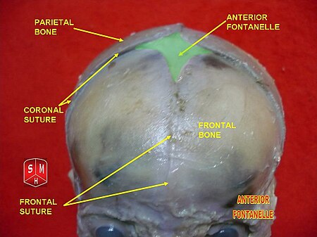 Anterior fontanelle.jpg