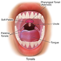 Illustration of frontal view of tonsils