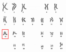 Human male karyotpe high resolution - Chromosome 13.png