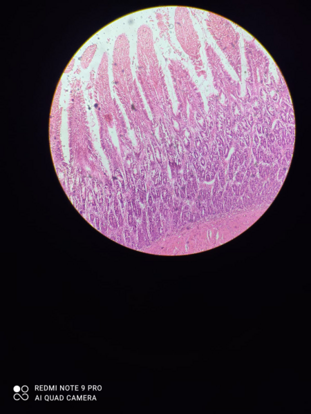 File:Jejunum.png