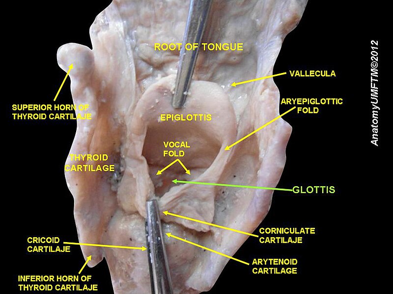 File:Slide7vvv.JPG