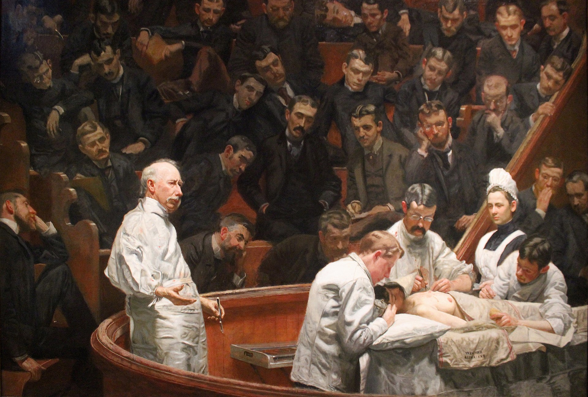 A wall of spectators watch a mastectomy being completed in a surgery amphitheatre, while a doctor lectures.