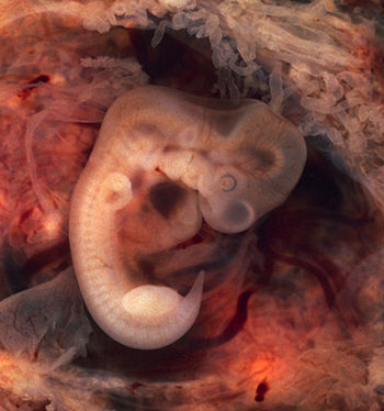 An opened oviduct with an ectopic pregnancy at...