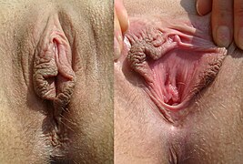 Vagina.