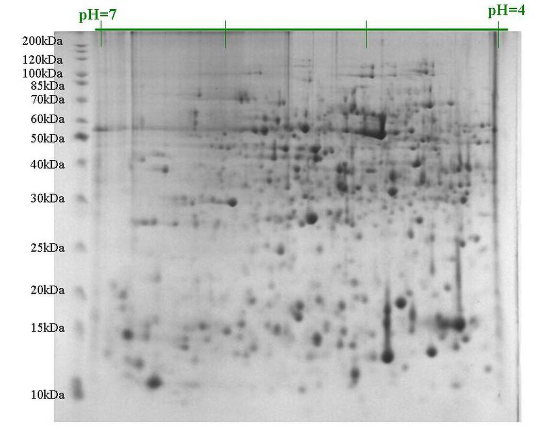 File:2D gel1.jpg