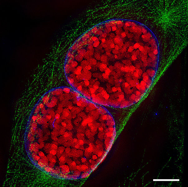 File:3D-SIM-3 Prophase 3 color.jpg