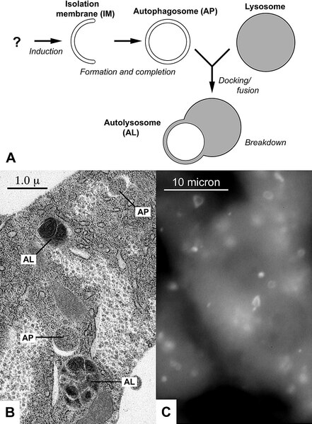 File:Autophagy diagram PLoS Biology.tif