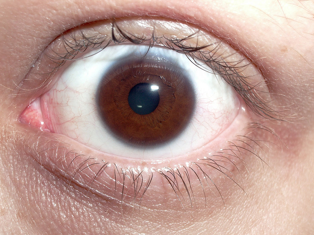 File:Human eye with blood vessels.jpg - Wikipedia