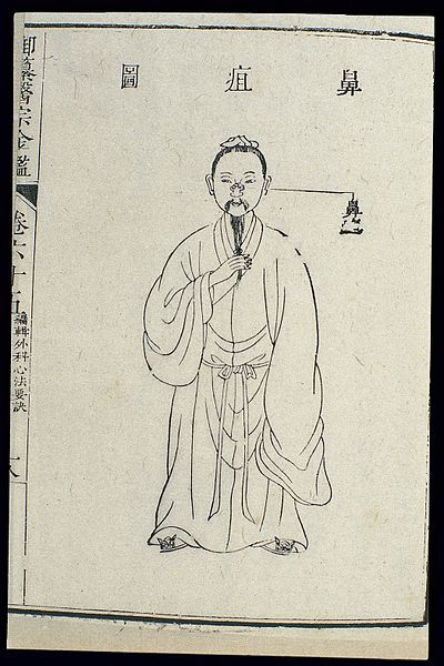 File:Chinese C18 woodcut; The nose - subcutaneous ulcers Wellcome L0039934.jpg