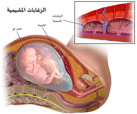 فحص الزغابات المشيمية Wikiwand