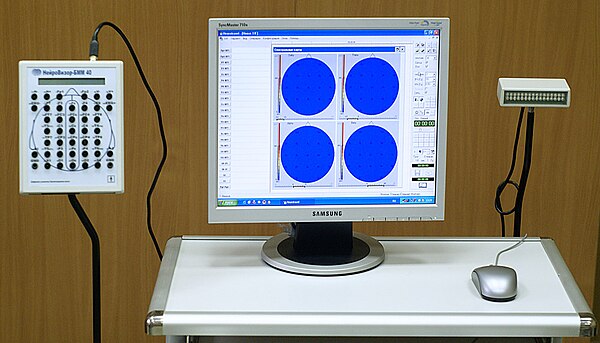 An electroencephalograph running on Windows XP. The medical industry's continued use of Windows XP is partly due to medical applications being incompa