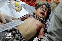 Injured child, 17 October 2023 Fars Photo of Casualties in Gaza Strip during 2023 War 31.jpg