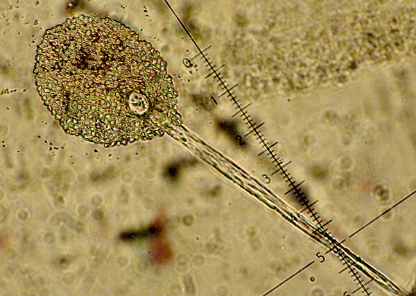 Sporangium of Fungi