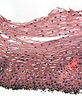 Thumbnail for Stratified squamous epithelium