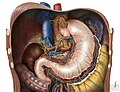 Fundoplicature de Nissen