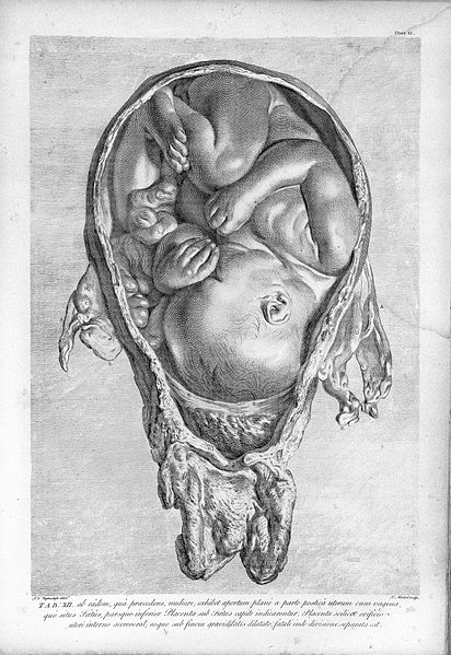 File:William Hunter, The anatomy of the human gravid uterus... Wellcome L0028167.jpg