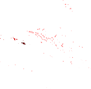 Covid-19 Pandemic In French Polynesia