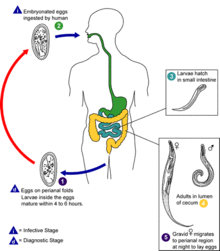 Enterobiosis tampon Fertőző és parazitás betegségek