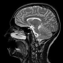 പ്രമാണം:Head MRI, sagittal plane, T₂ weighted.webm
