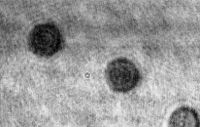 Phase-contrast image of human blood erythrocytes obtained by the wave addition in a bright interference fringe Human blood erythrocytes.jpg