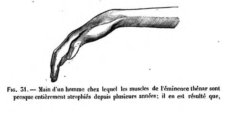 File:Huxley - De la place de l'homme dans la nature (page 246 crop)-1.jpg