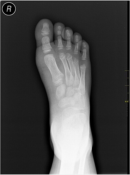 File:Medical X-Ray imaging UDM07 nevit.jpg