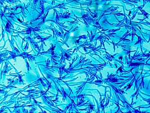 Мікраарганізм: мікраскапічны жывы арганізм