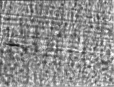 Micrograph of polypropylene